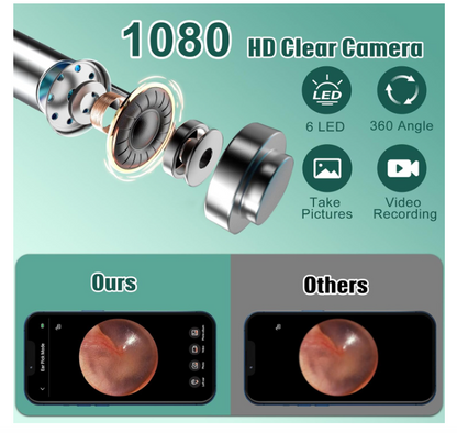 Smart Visual Ear Cleaner