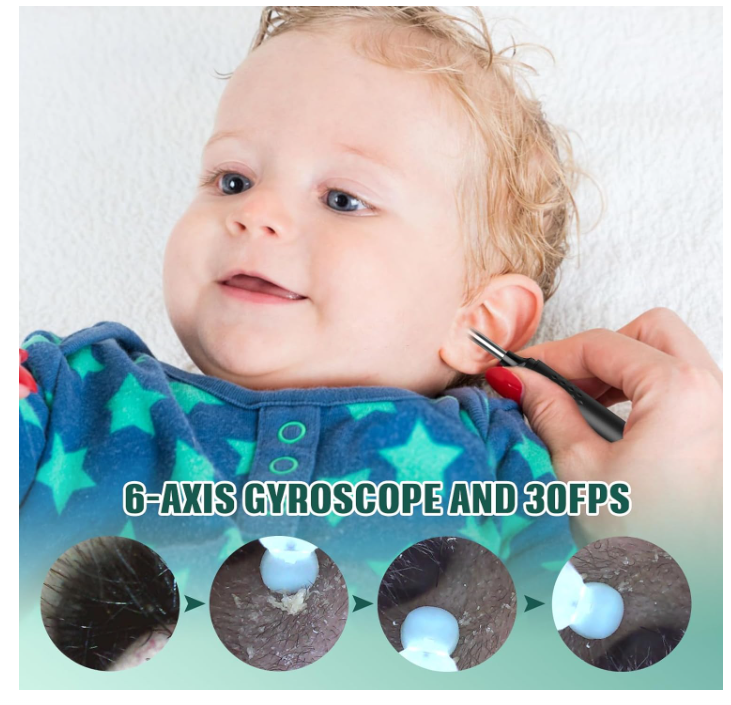 Smart Visual Ear Cleaner