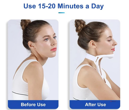 Posture Correcting Neck Brace